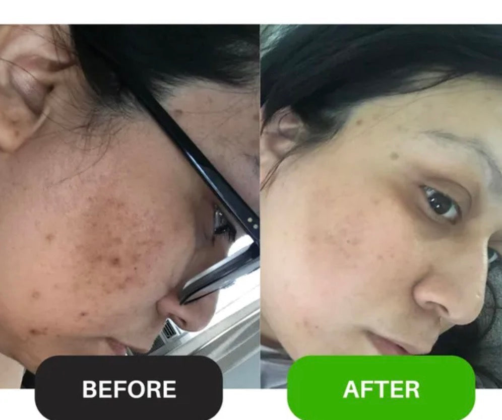 Glow & Renew – Ultimate Serum Combo (3-in-1 Skincare Set)