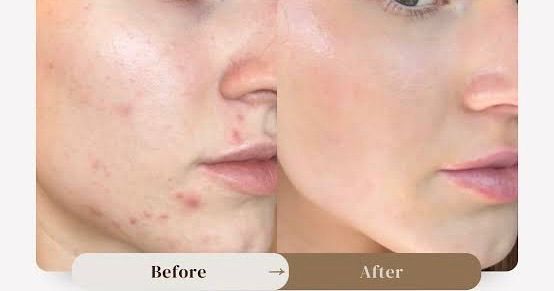 Gree & Glow – Complete Skincare Glow Pack